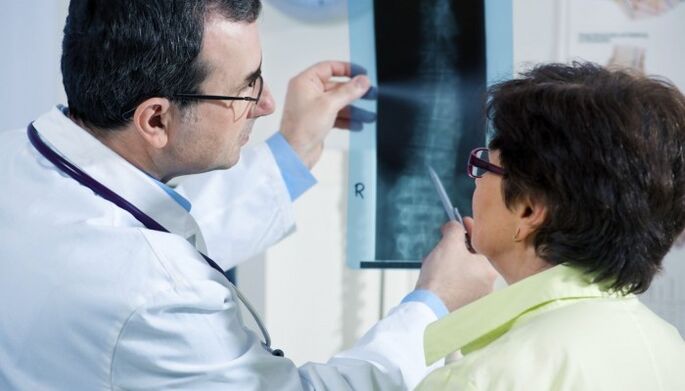 radiografie a coloanei vertebrale cu osteocondroză