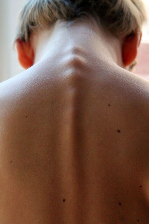 vertebre