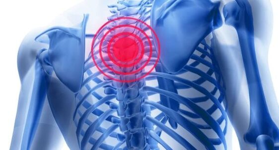 Tratamentul osteochondrozei coloanei vertebrale toracice